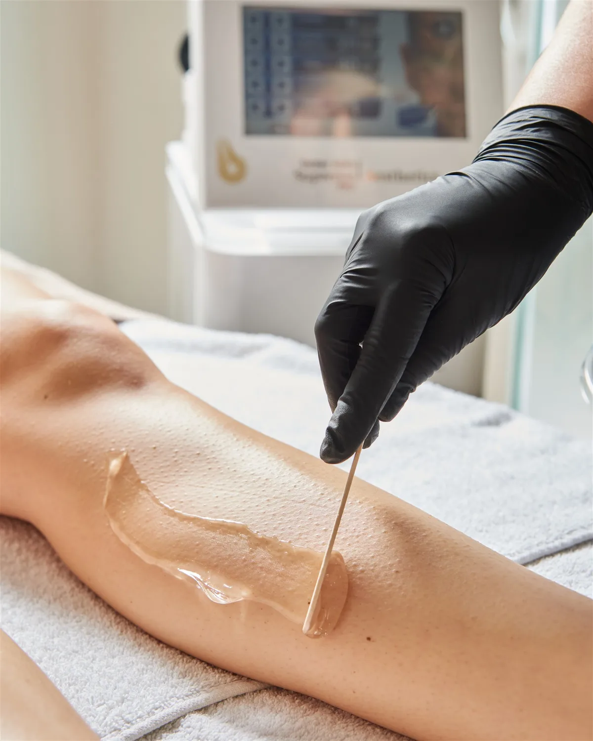 Applicazione del gel sulla gamba prima della seduta di epilazione laser