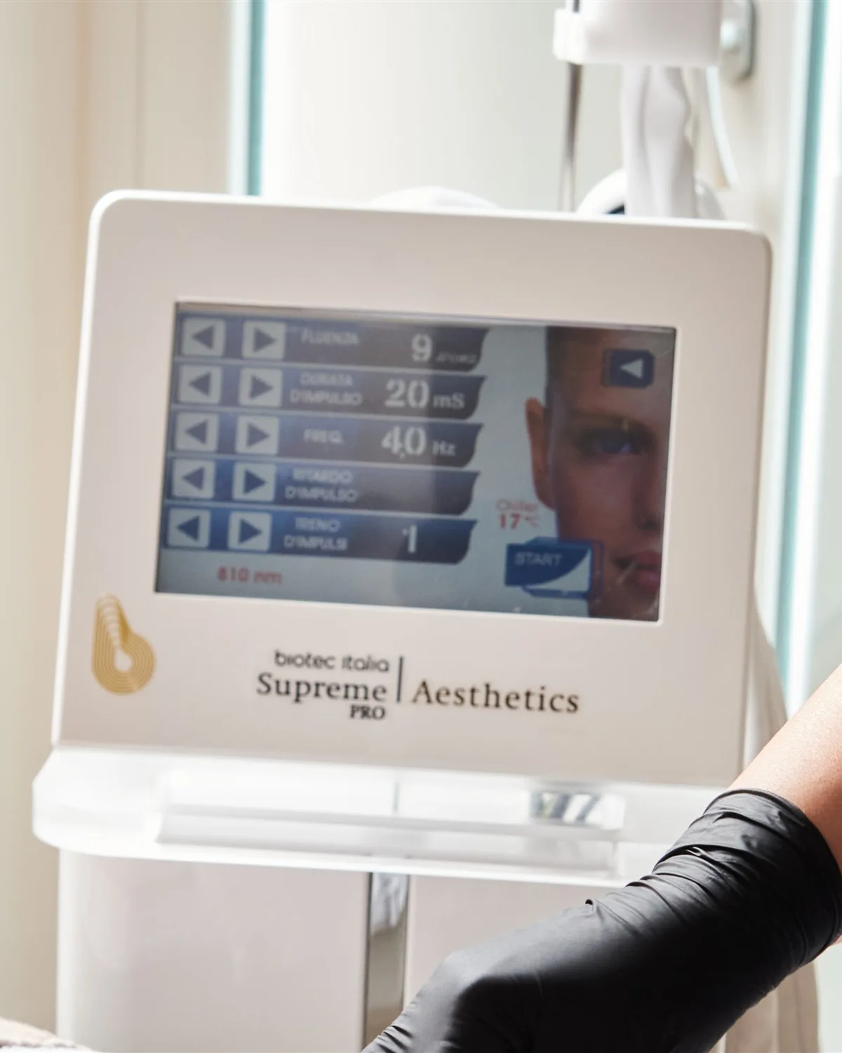 Apparecchio per epilazione laser Biotec Italia con schermo dei parametri