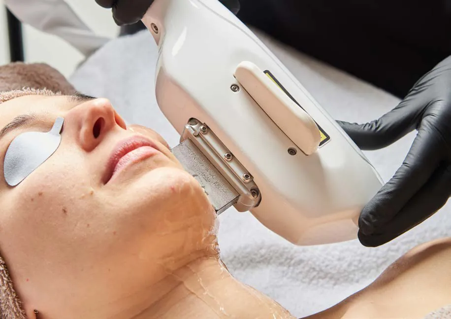 Trattamento viso con tecnologia CPL e occhiali di protezione